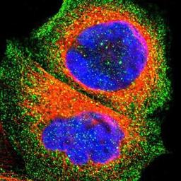 Immunocytochemistry/Immunofluorescence: OATP1B3/SLCO1B3/OATP8 Antibody [NBP1-80980] - Staining of human cell line A-431 shows positivity in cytoplasm.