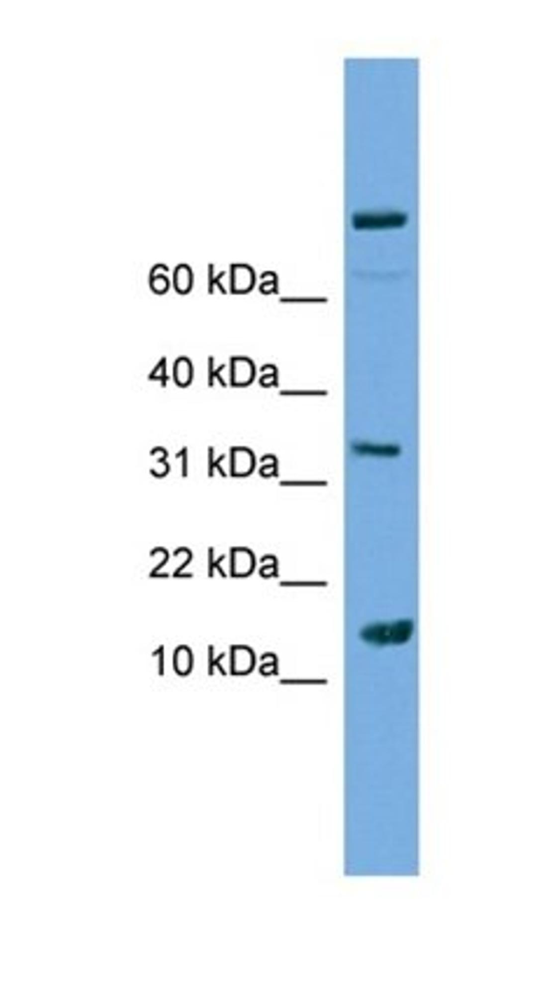 Western blot analysis of Jurkat cell lysate tissue using PLA2G2E antibody