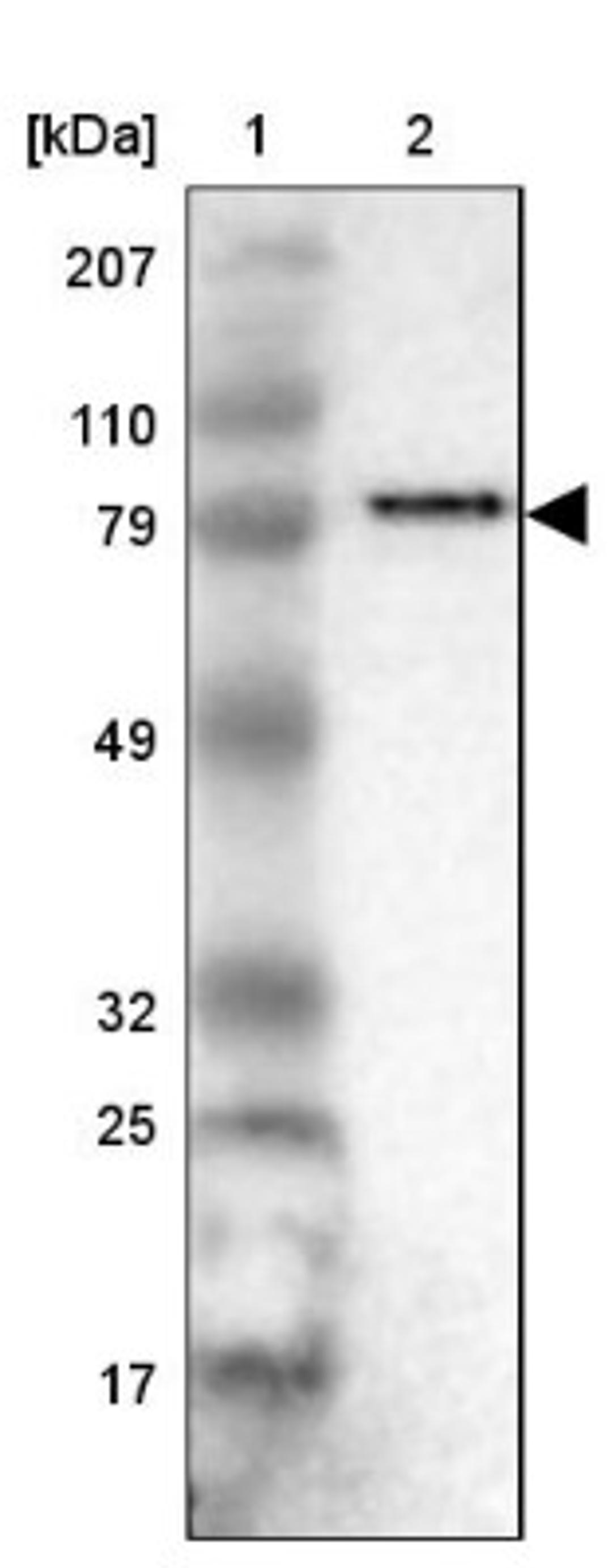 Western Blot: ANGEL1 Antibody [NBP1-81481] - Lane 1: Marker [kDa] 207, 110, 79, 49, 32, 25, 17<br/>Lane 2: Human cell line RT-4