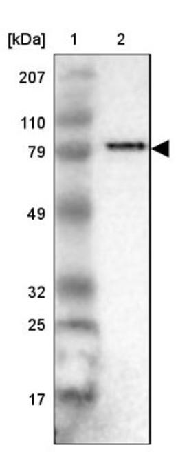 Western Blot: ANGEL1 Antibody [NBP1-81481] - Lane 1: Marker [kDa] 207, 110, 79, 49, 32, 25, 17<br/>Lane 2: Human cell line RT-4