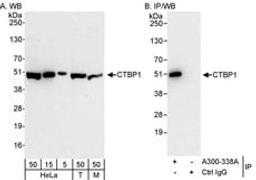 Detection of human and mouse CTBP1 by western blot (h&m) and immunoprecipitation (h).