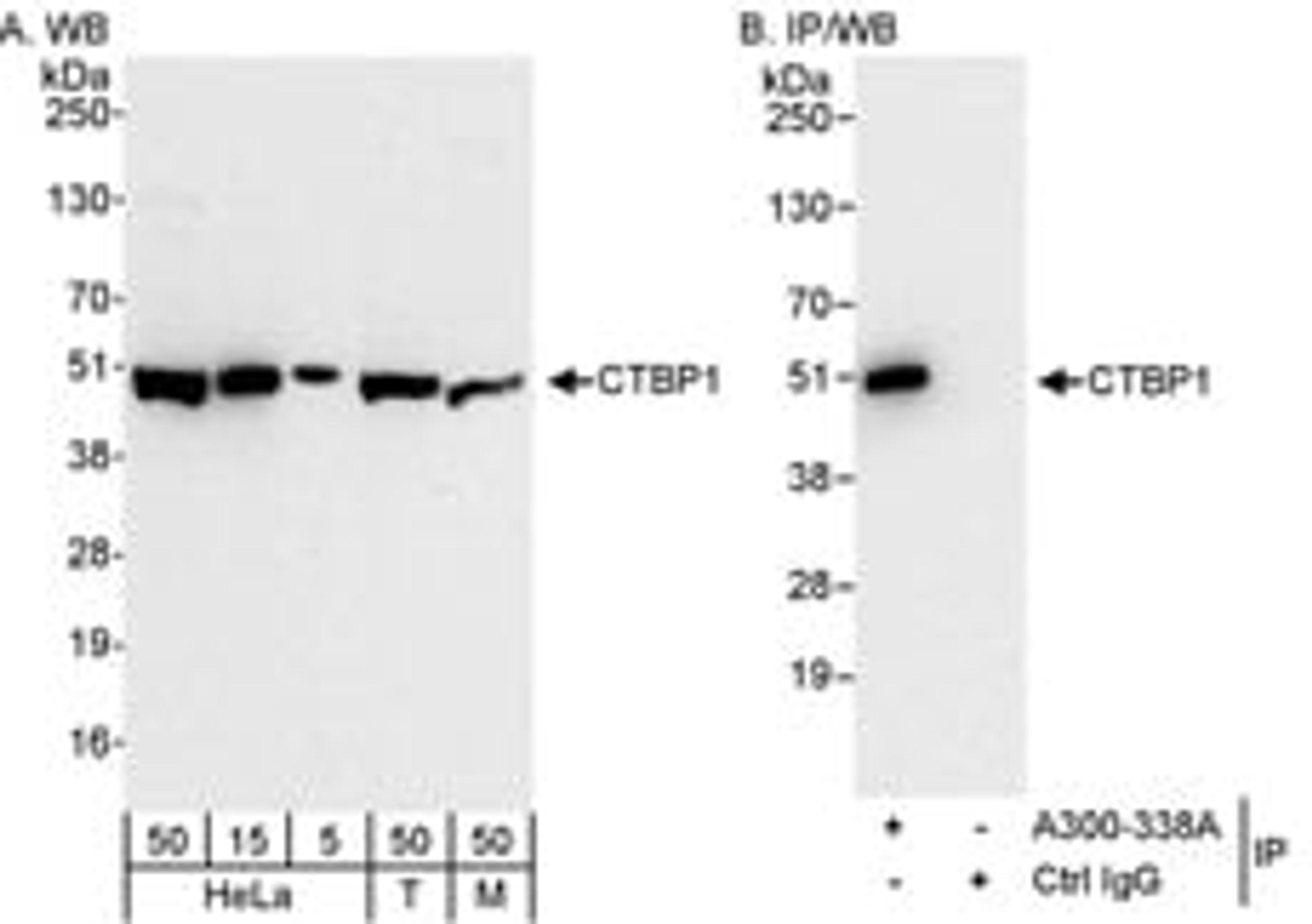 Detection of human and mouse CTBP1 by western blot (h&m) and immunoprecipitation (h).