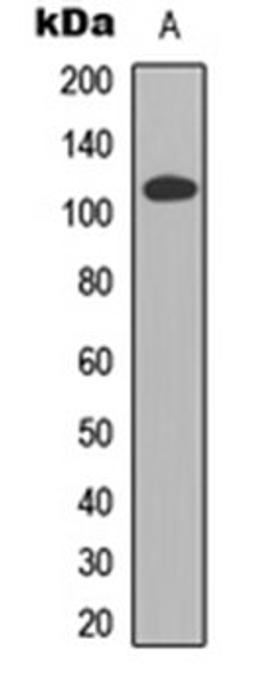 Western blot analysis of HEK293T (Lane 1) whole cell lysates using CDCA2 antibody