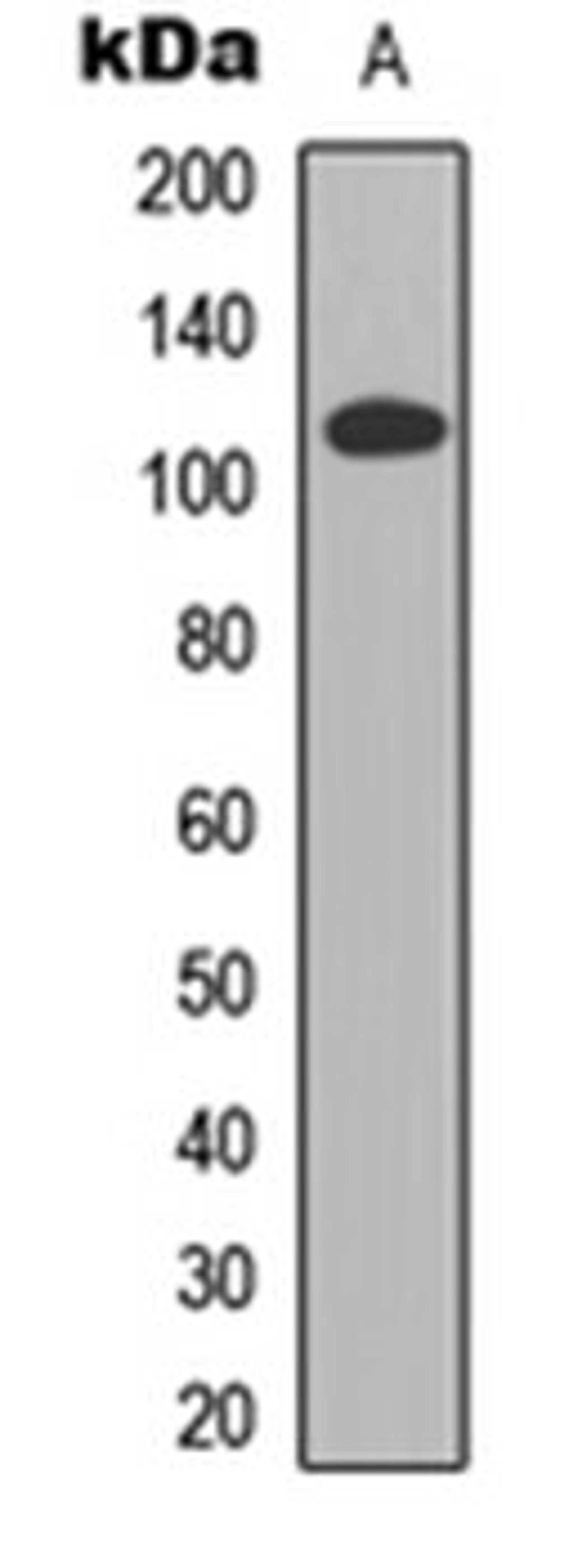 Western blot analysis of HEK293T (Lane 1) whole cell lysates using CDCA2 antibody