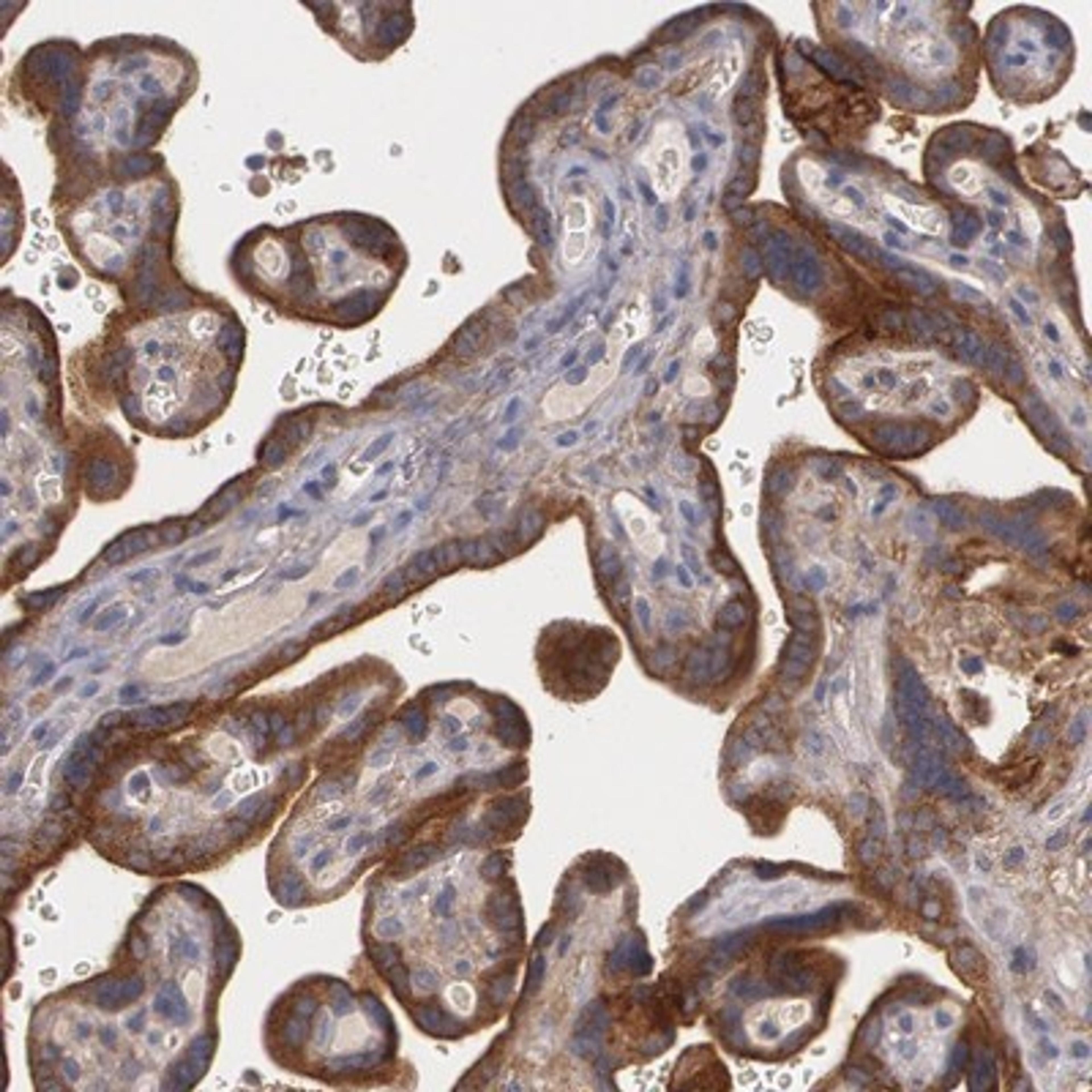 Immunohistochemistry-Paraffin: Fibulin 1 Antibody [NBP1-84725] - Staining of human placenta shows cytoplasmic and membranous positivity in trophoblastic cells.