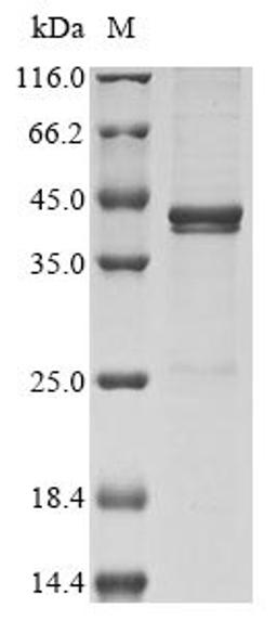 (Tris-Glycine gel) Discontinuous SDS-PAGE (reduced) with 5% enrichment gel and 15% separation gel.