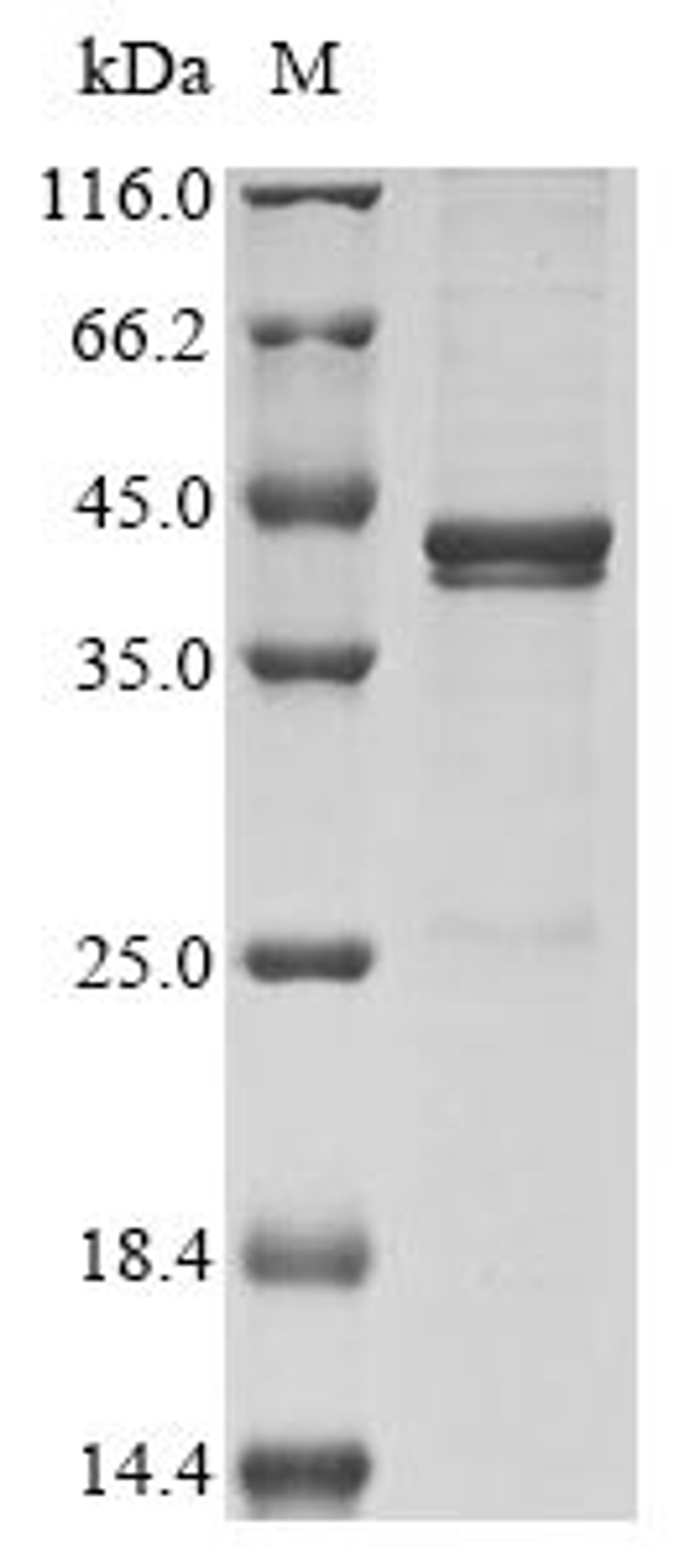 (Tris-Glycine gel) Discontinuous SDS-PAGE (reduced) with 5% enrichment gel and 15% separation gel.
