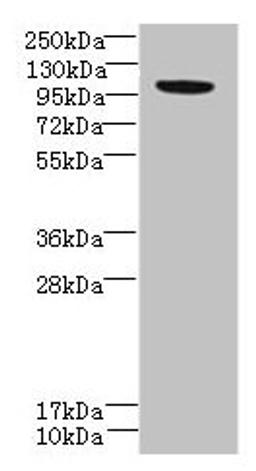 Western blot. All lanes: PPFIBP2 antibody at 6µg/ml + HepG2 whole cell lysate. Secondary. Goat polyclonal to rabbit at 1/10000 dilution. Predicted band size: 99, 87, 84 kDa. Observed band size: 99 kDa