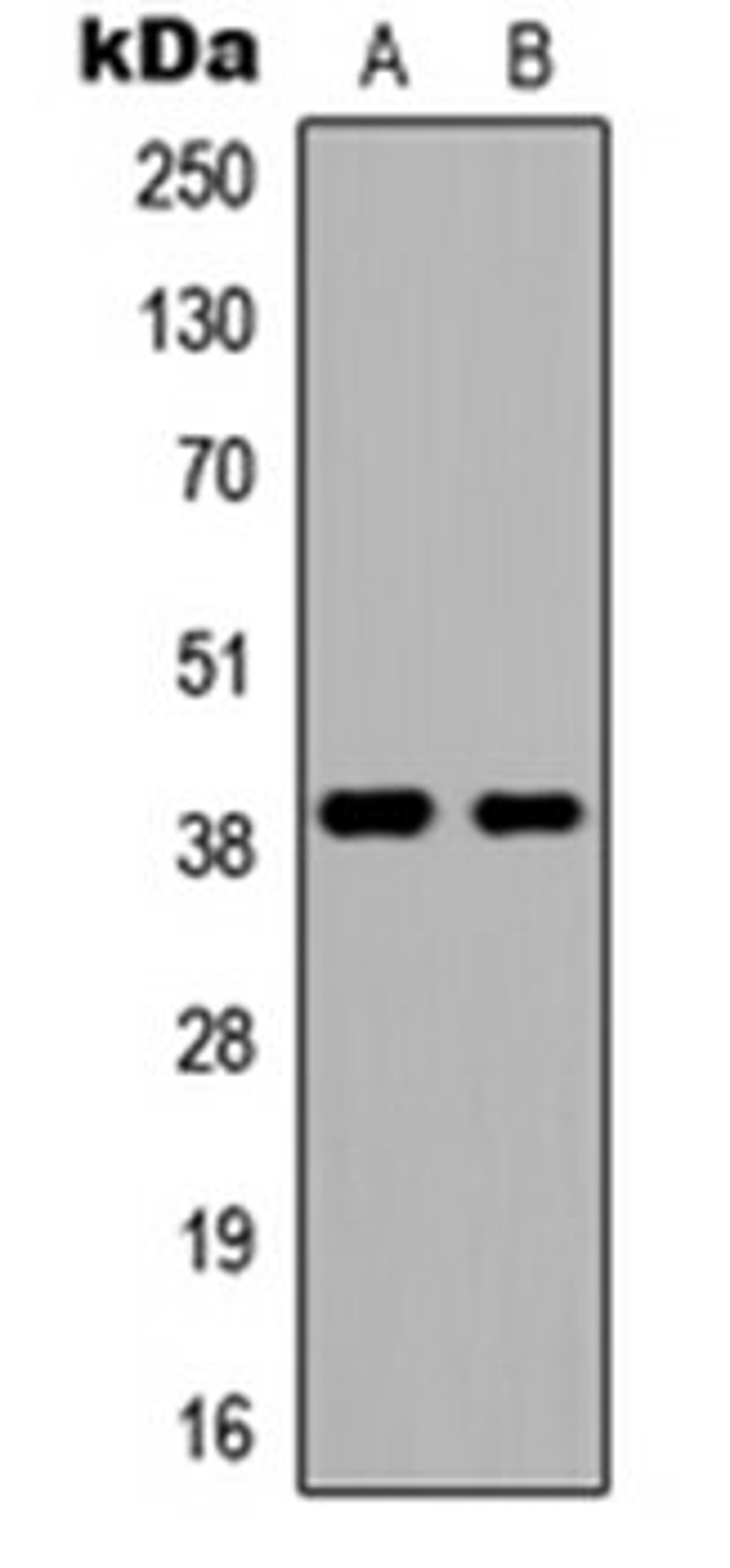 Western blot analysis of HEK293T (Lane 1), NIH3T3 (Lane 2) whole cell lysates using DMRTC2 antibody