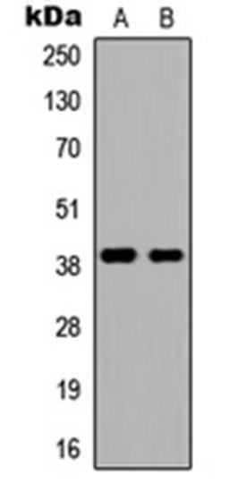 Western blot analysis of HEK293T (Lane 1), NIH3T3 (Lane 2) whole cell lysates using DMRTC2 antibody