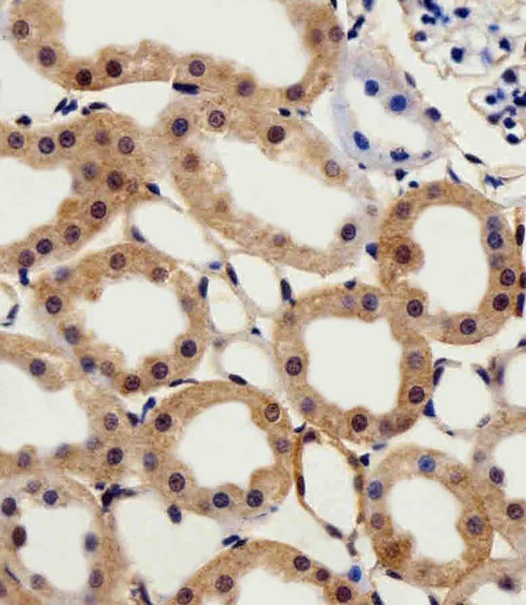 Immunohistochemical analysis of paraffin-embedded R.kidney section using CSNK2A1 Antibody . Antibody was diluted at 1:25 dilution. A peroxidase-conjugated goat anti-rabbit IgG at 1:400 dilution was used as the secondary antibody, followed by DAB staining.