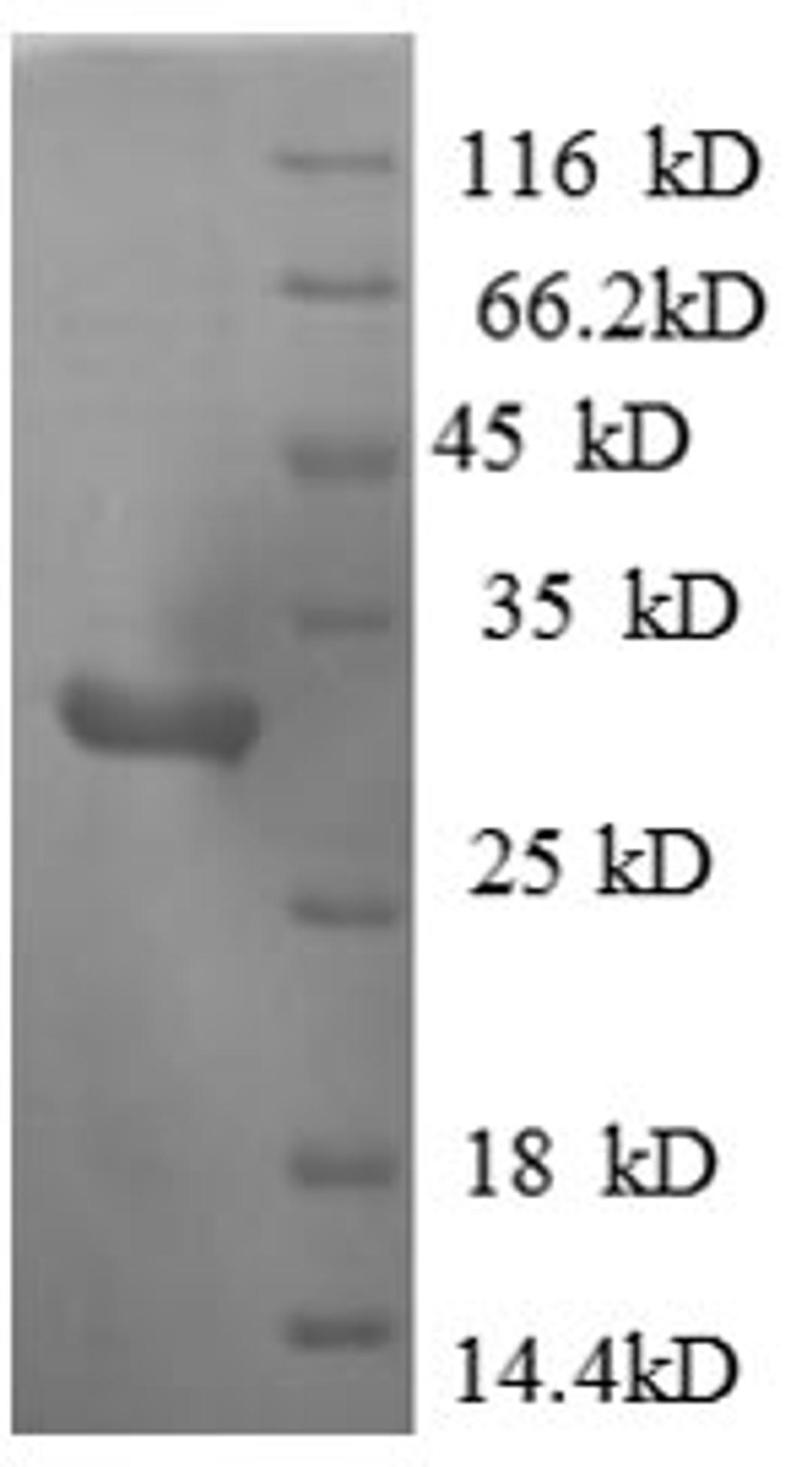 (Tris-Glycine gel) Discontinuous SDS-PAGE (reduced) with 5% enrichment gel and 15% separation gel.