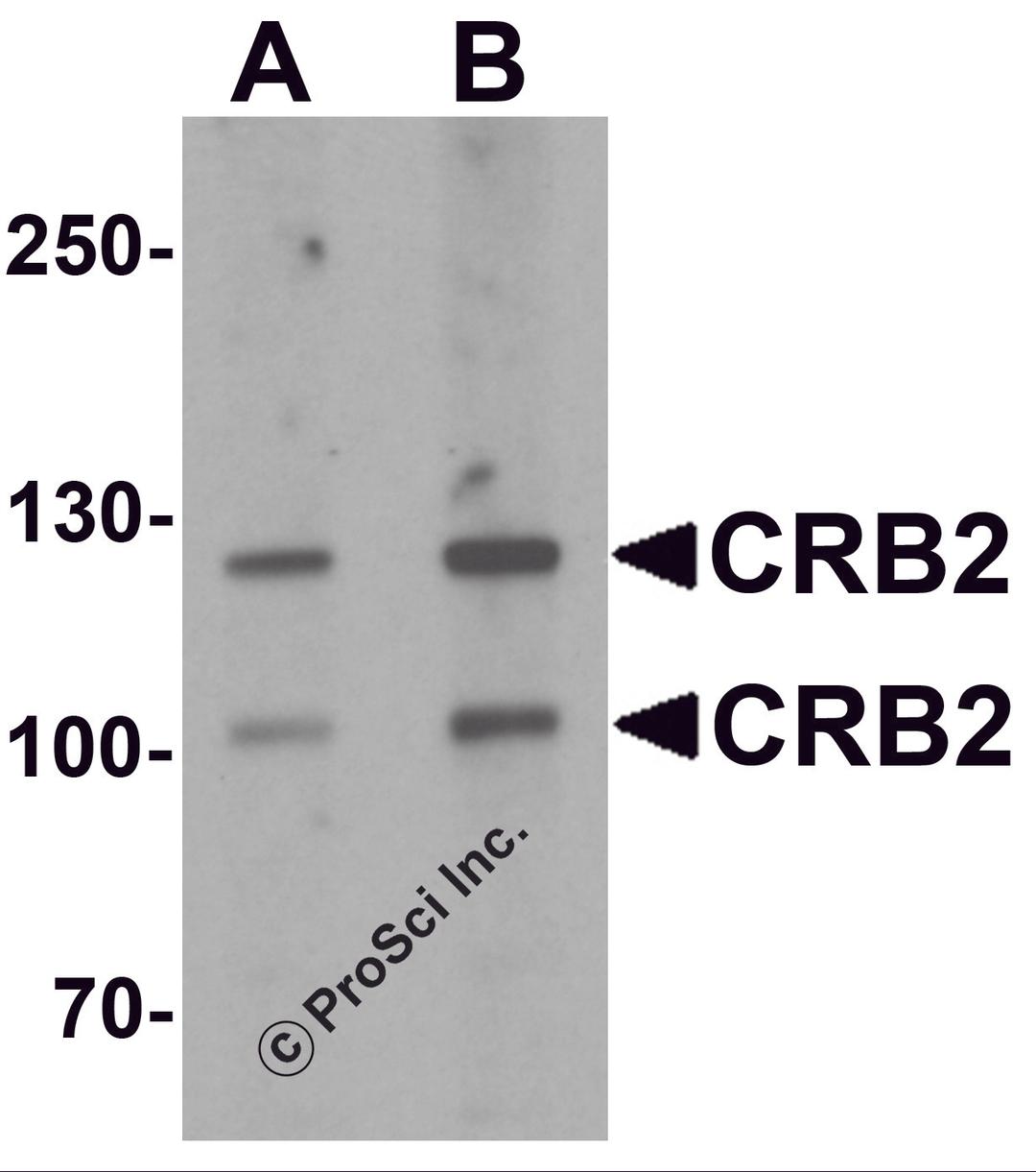 Western blot analysis of CRB2 in rat brain tissue lysate with CRB2 antibody at (A) 0.5 and (B) 1 μg/mL