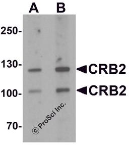 Western blot analysis of CRB2 in rat brain tissue lysate with CRB2 antibody at (A) 0.5 and (B) 1 μg/mL
