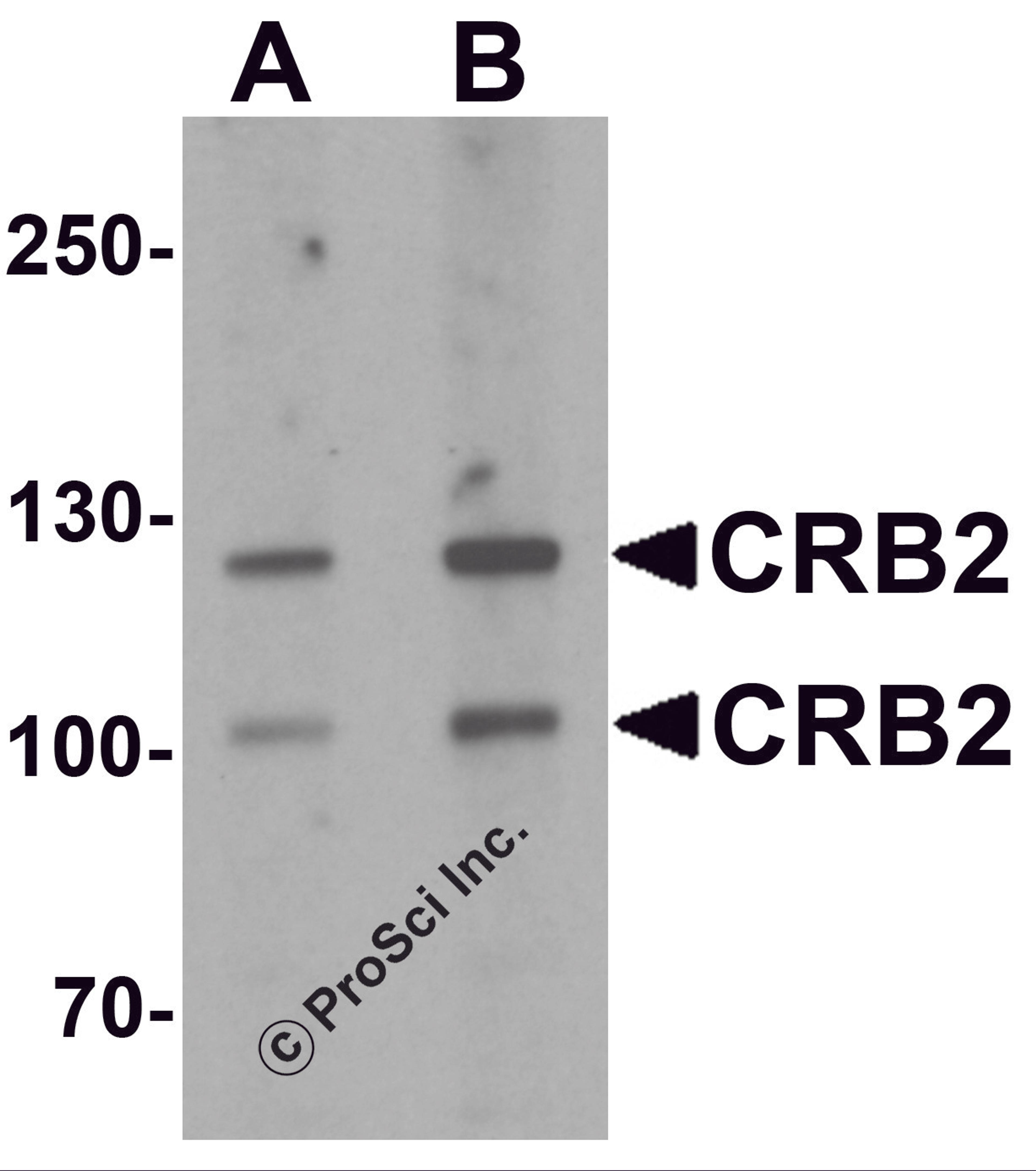 Western blot analysis of CRB2 in rat brain tissue lysate with CRB2 antibody at (A) 0.5 and (B) 1 μg/mL