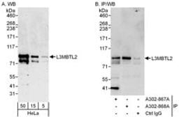 Detection of human L3MBTL2 by western blot and immunoprecipitation.