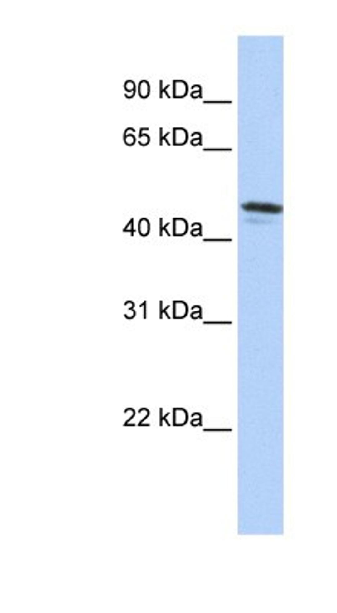 Western Blot: Diffuse panbronchiolitis critical region protein 1 Antibody [NBP1-60094] - Titration: 0.2-1 ug/ml, Positive Control: HepG2 cell lysate.