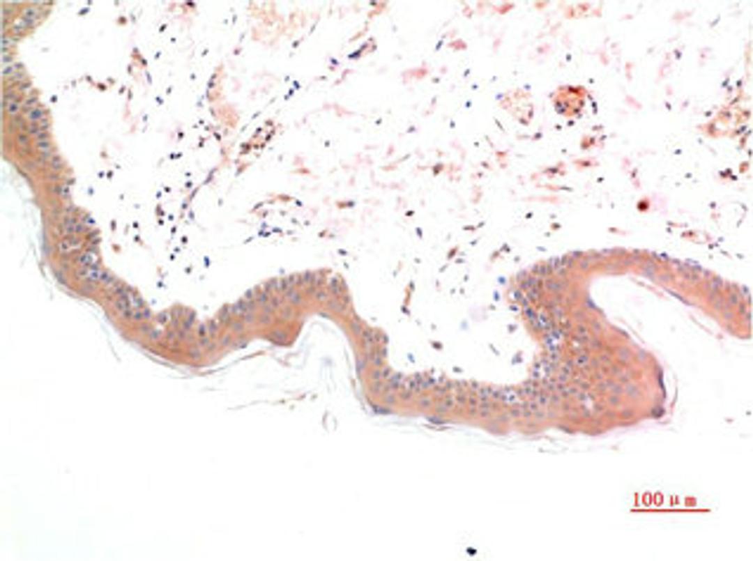 Immunohistochemical analysis of paraffin-embedded Human Skin Tissue using Phospho-Smad3(S425) Mouse mAb diluted at 1:200.