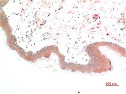 Immunohistochemical analysis of paraffin-embedded Human Skin Tissue using Phospho-Smad3(S425) Mouse mAb diluted at 1:200.