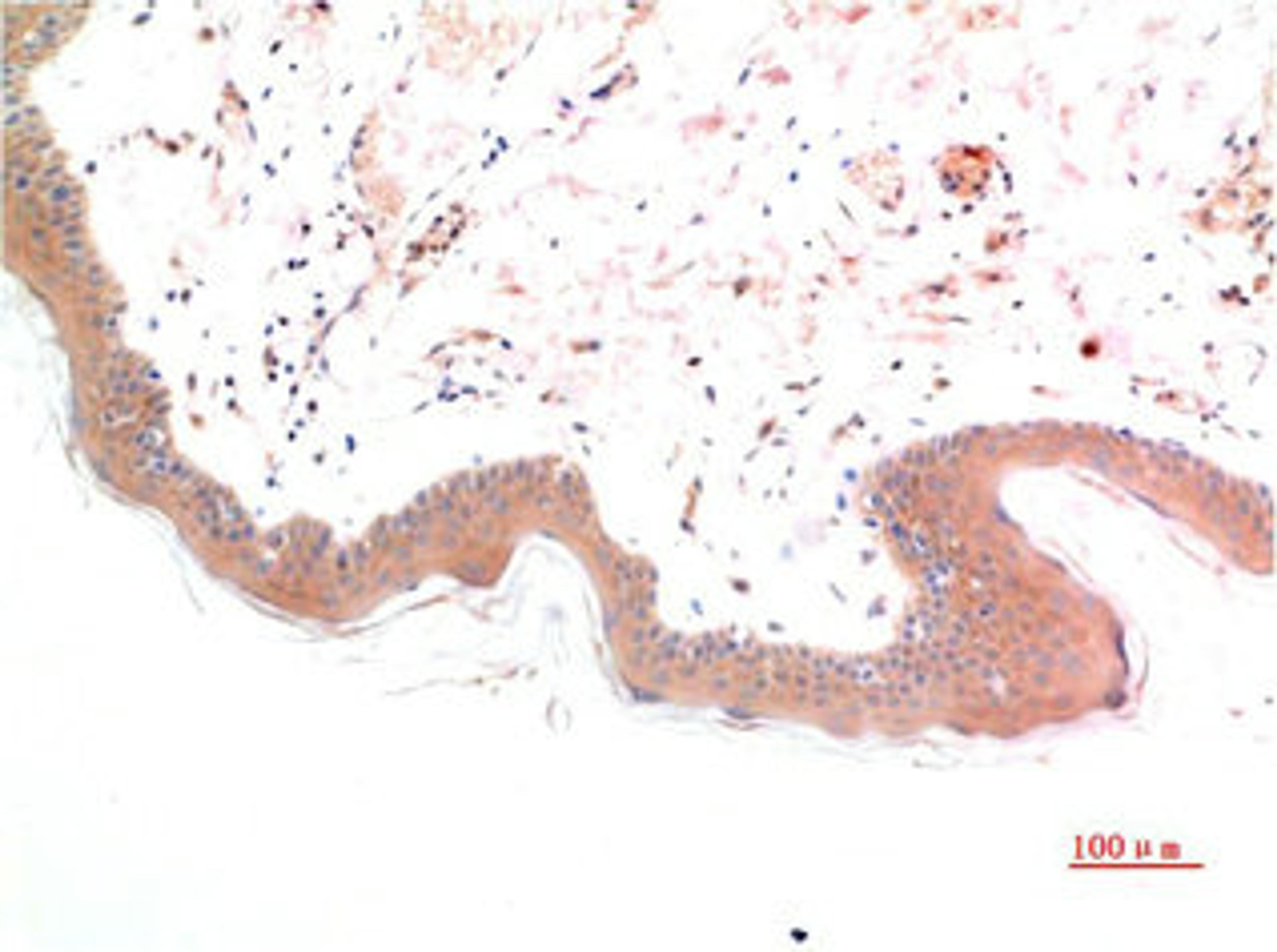 Immunohistochemical analysis of paraffin-embedded Human Skin Tissue using Phospho-Smad3(S425) Mouse mAb diluted at 1:200.