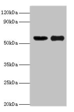 Western blot. All lanes: OXCT1 antibody at 8ug/ml. Lane 1: Mouse heart tissue. Lane 2: Mouse kidney tissue. Secondary. Goat polyclonal to rabbit IgG at 1/10000 dilution. Predicted band size: 57, 14 kDa. Observed band size: 57 kDa. 
