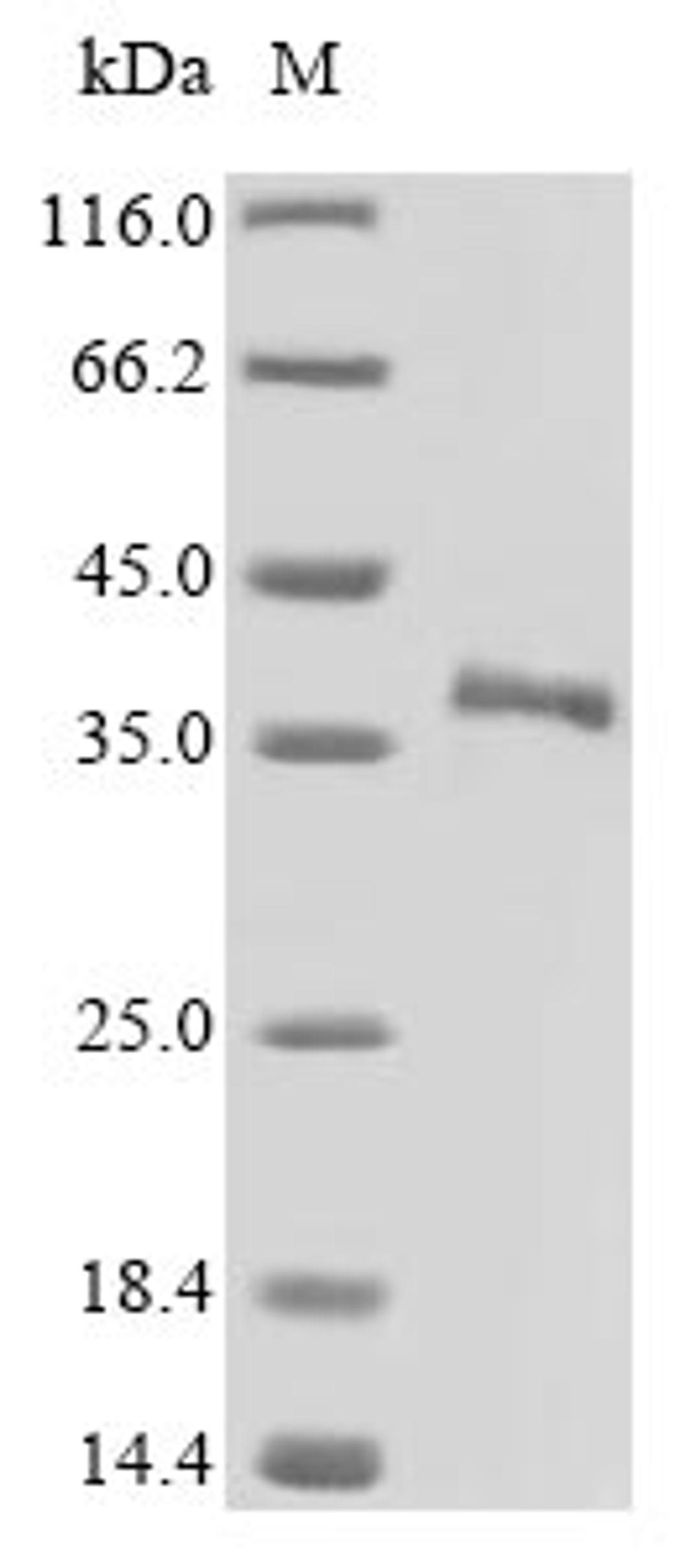 (Tris-Glycine gel) Discontinuous SDS-PAGE (reduced) with 5% enrichment gel and 15% separation gel.