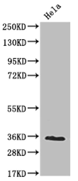 Western Blot. Positive WB detected in: Hela whole cell lysate. All lanes: NUDT5 antibody at 1:2000. Secondary. Goat polyclonal to rabbit IgG at 1/50000 dilution. Predicted band size: 25 kDa. Observed band size: 36 kDa.