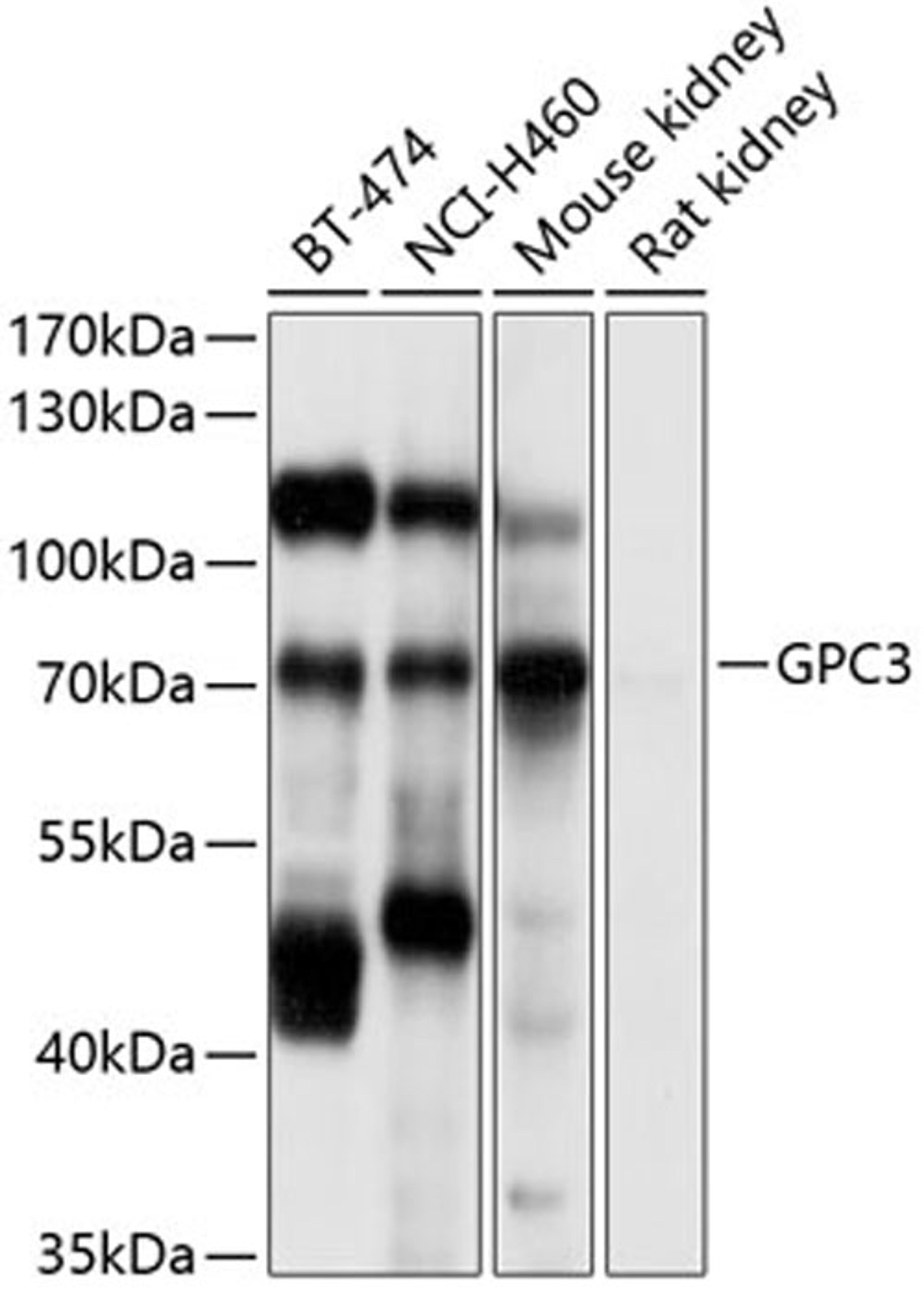 Western blot - GPC3 antibody (A12384)