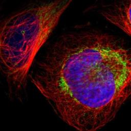 Immunocytochemistry/Immunofluorescence: C14orf119 Antibody [NBP1-82164] - Staining of human cell line U-2 OS shows positivity in mitochondria.