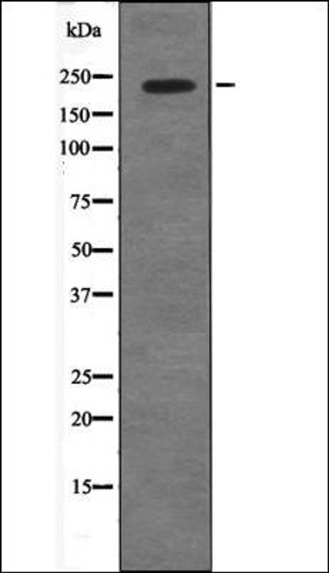 Western blot analysis of COS7 whole cell lysates using 53BP1 -Phospho-Ser29- antibody