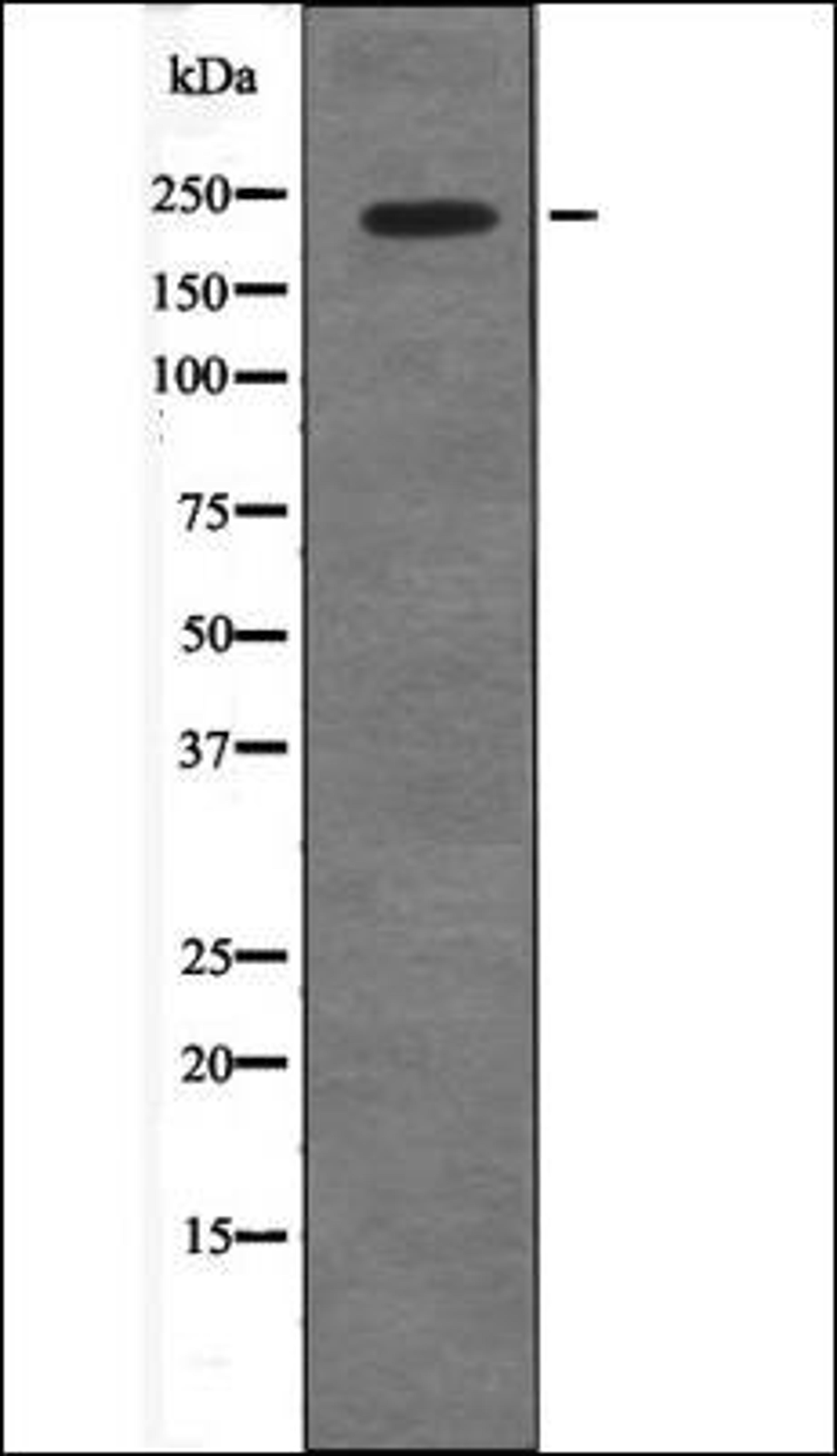 Western blot analysis of COS7 whole cell lysates using 53BP1 -Phospho-Ser29- antibody