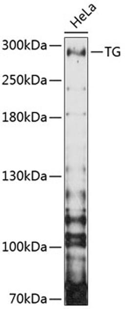 Western blot - TG antibody (A11708)