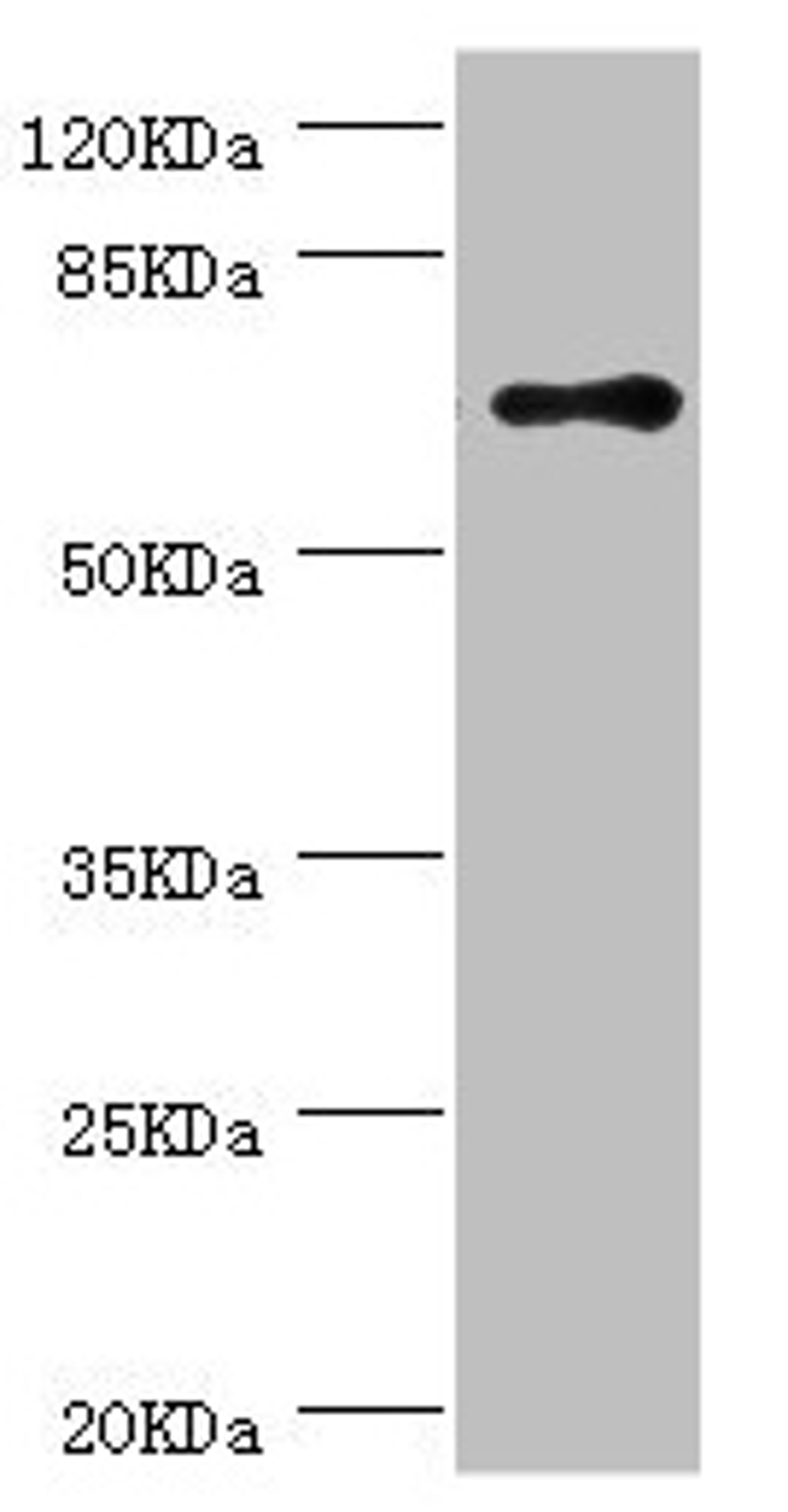 Western blot. All lanes: RNGTT antibody at 1.42µg/ml + THP-1 whole cell lysate. Secondary. Goat polyclonal to rabbit IgG at 1/10000 dilution. Predicted band size: 69, 67, 53, 62 kDa. Observed band size: 69 kDa