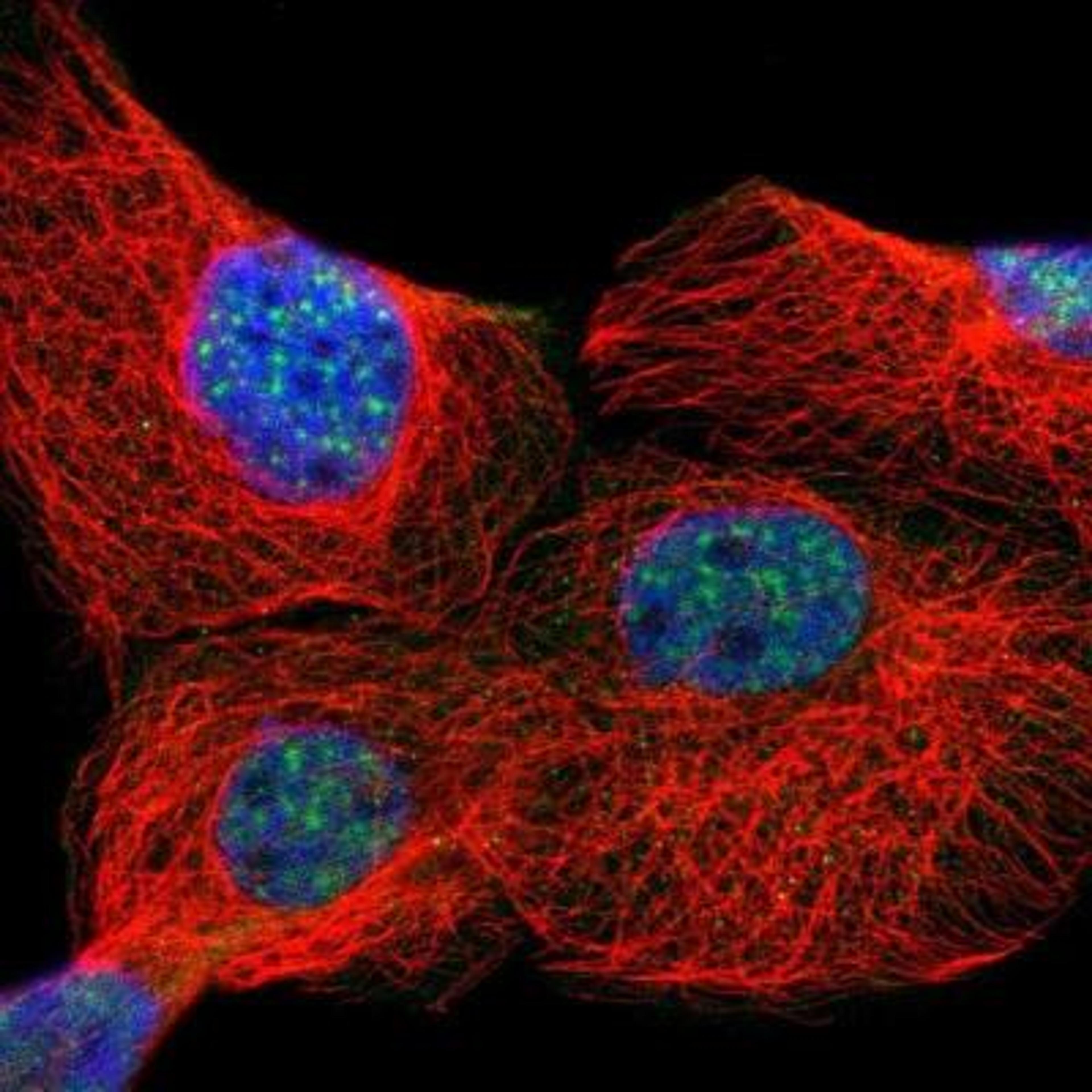 Immunocytochemistry/ Immunofluorescence: ZNF179 Antibody [NBP2-13236] - Staining of human cell line A-431 shows positivity in nucleus but not nucleoli.