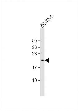 Western Blot at 1:1000 dilution + ZR-75-1 whole cell lysate Lysates/proteins at 20 ug per lane.