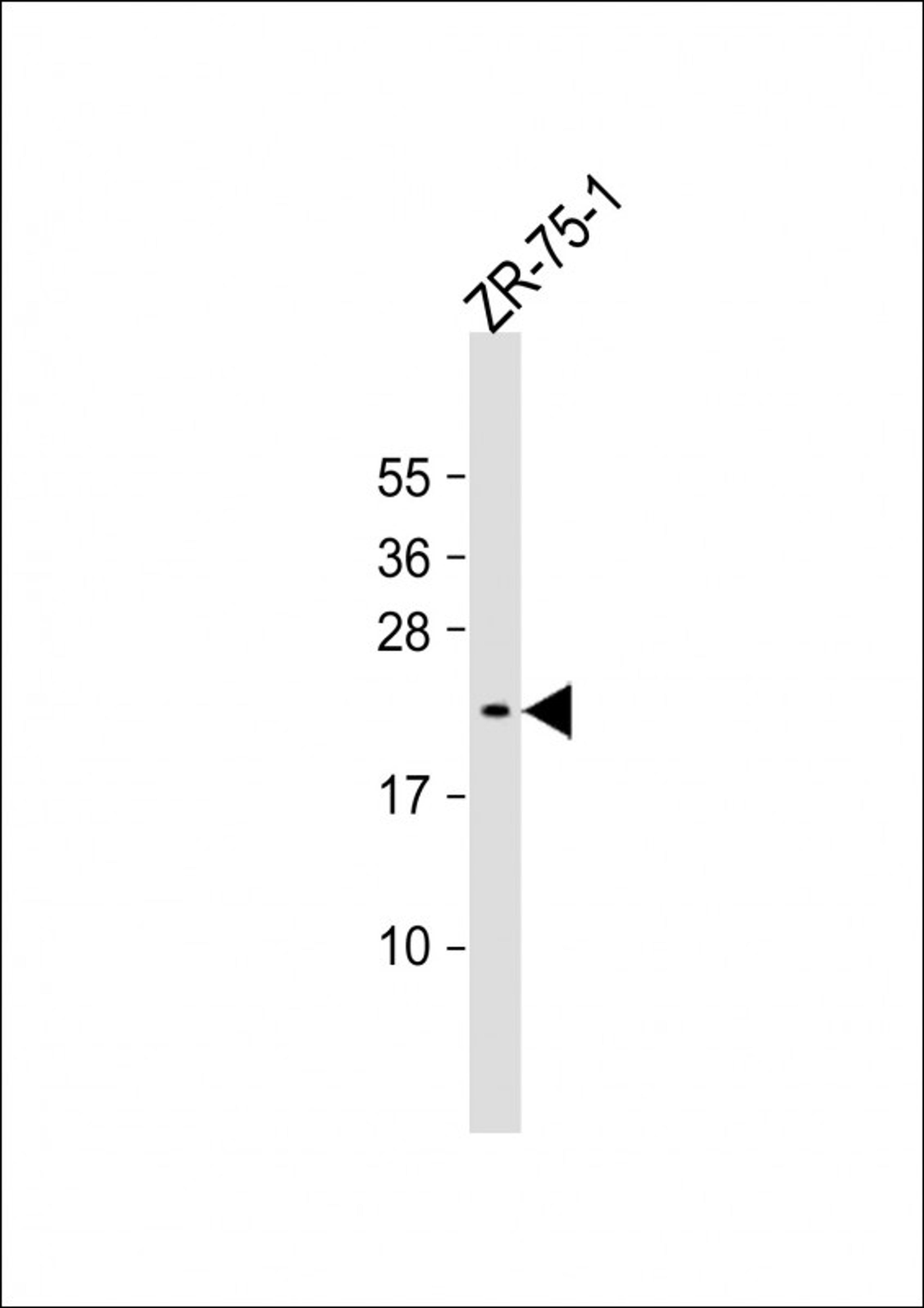 Western Blot at 1:1000 dilution + ZR-75-1 whole cell lysate Lysates/proteins at 20 ug per lane.