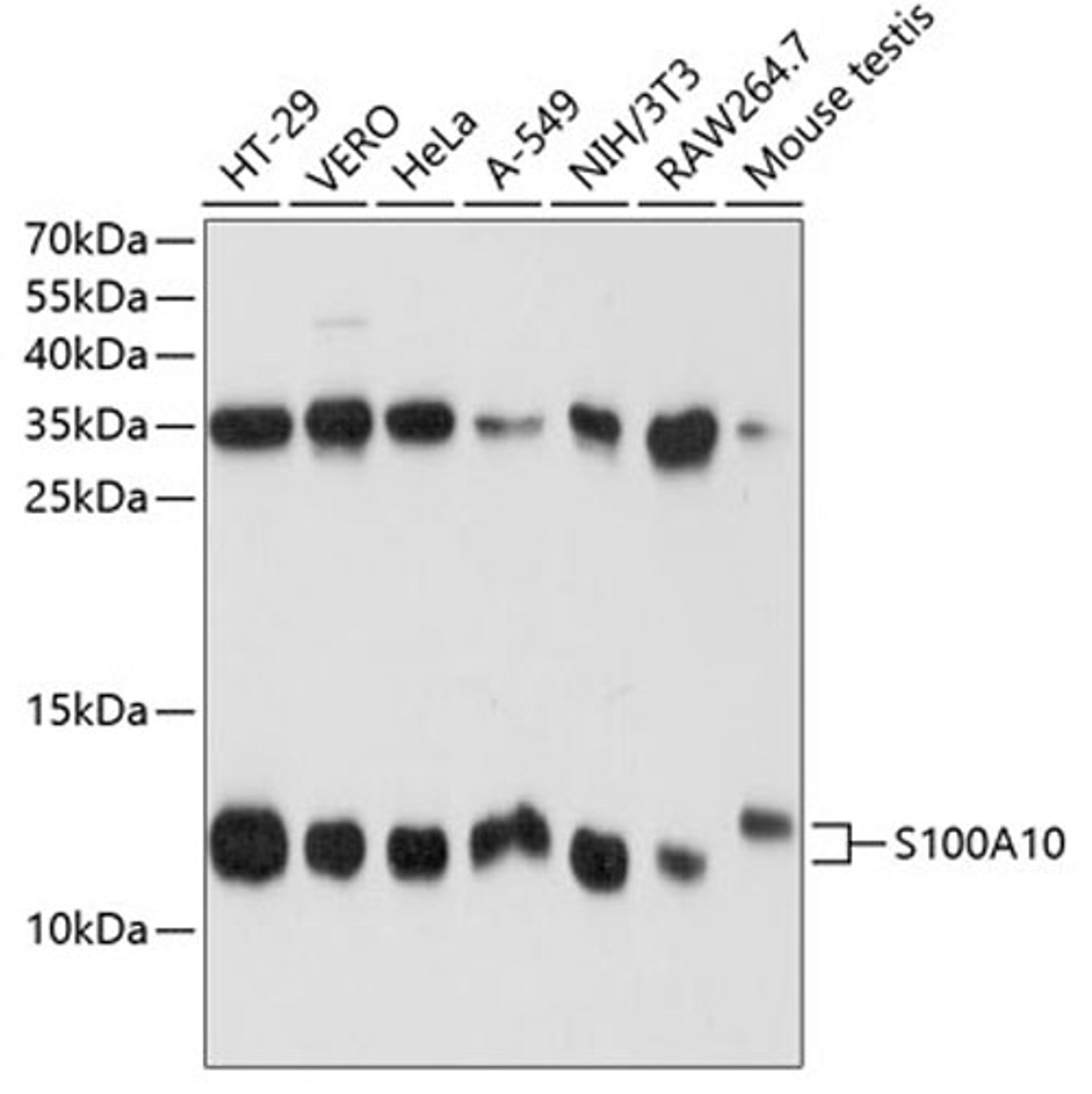 Western blot - S100A10 antibody (A1987)