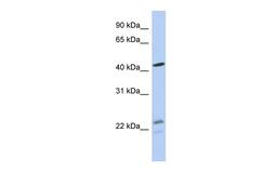 Antibody used in WB on Human MCF-7 at 0.2-1 ug/ml.