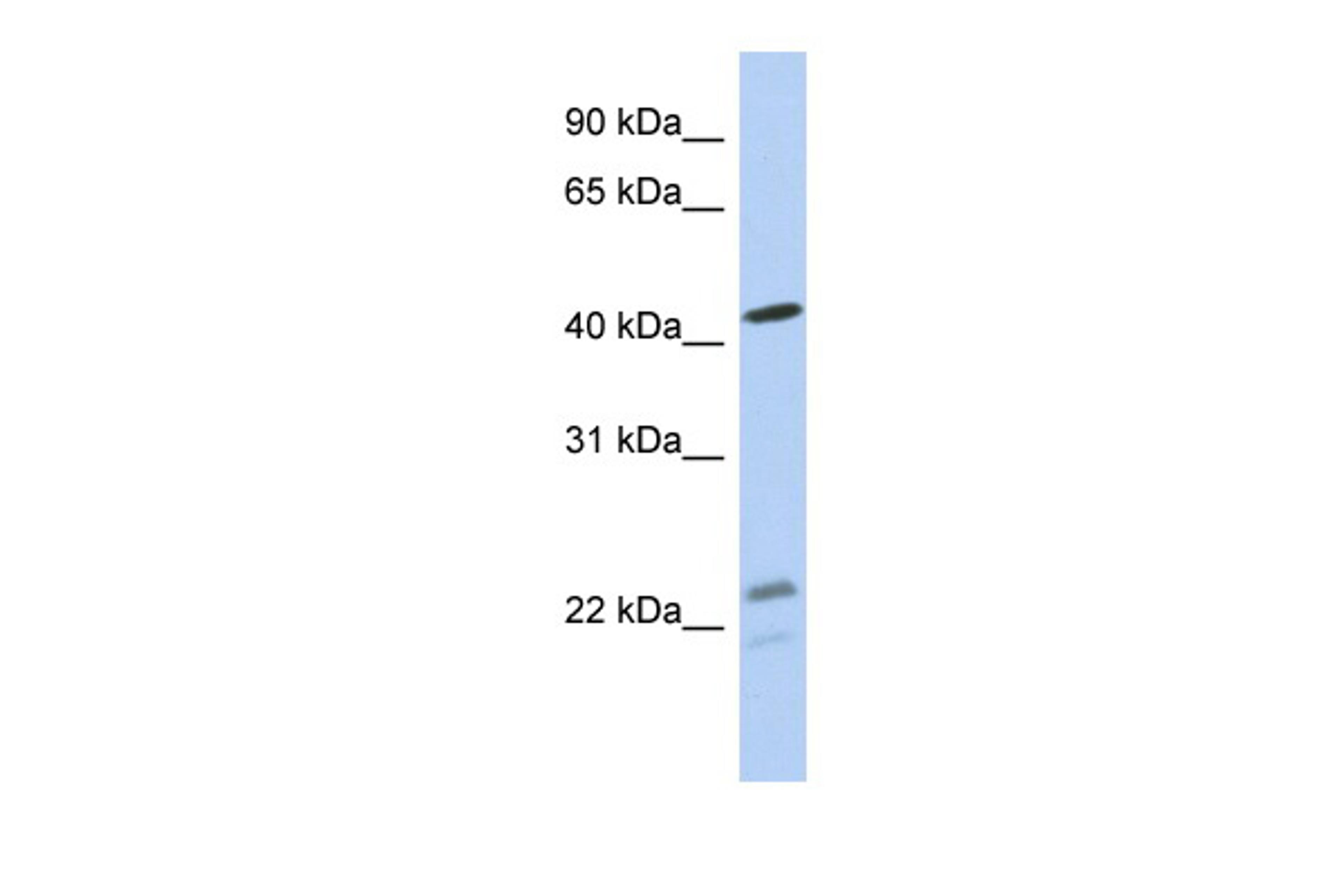 Antibody used in WB on Human MCF-7 at 0.2-1 ug/ml.