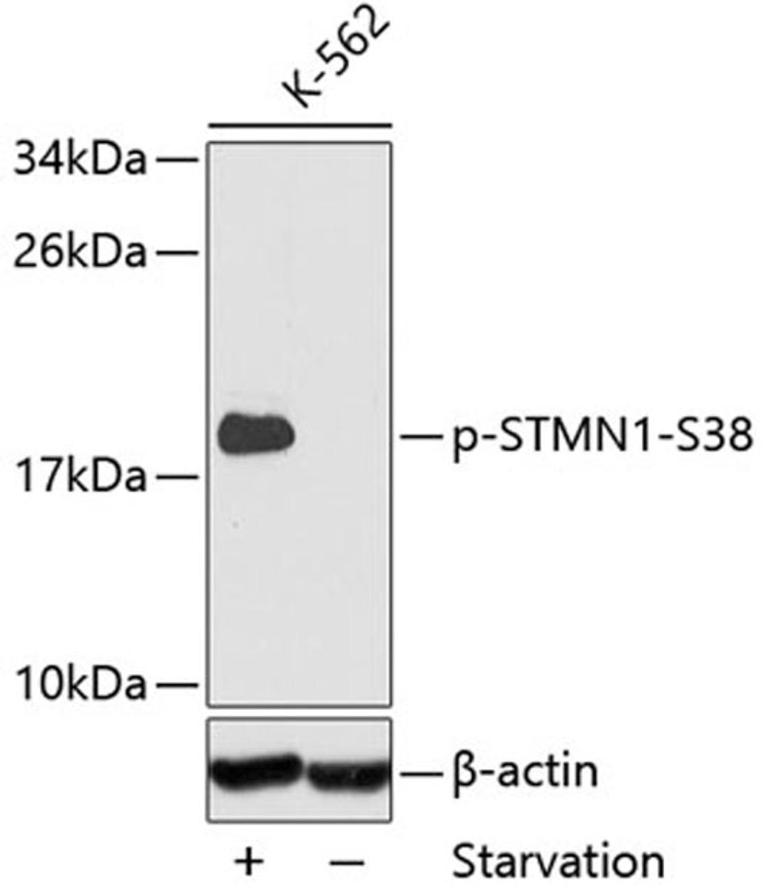 Western blot - Phospho-STMN1-S38 antibody (AP0221)