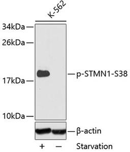 Western blot - Phospho-STMN1-S38 antibody (AP0221)