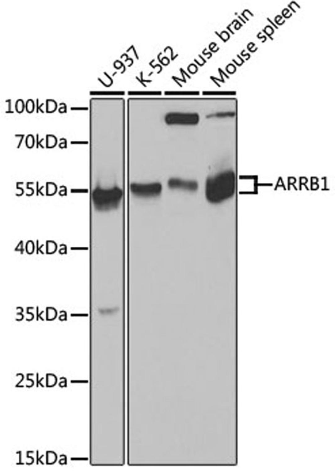 Western blot - ARRB1 antibody (A0998)