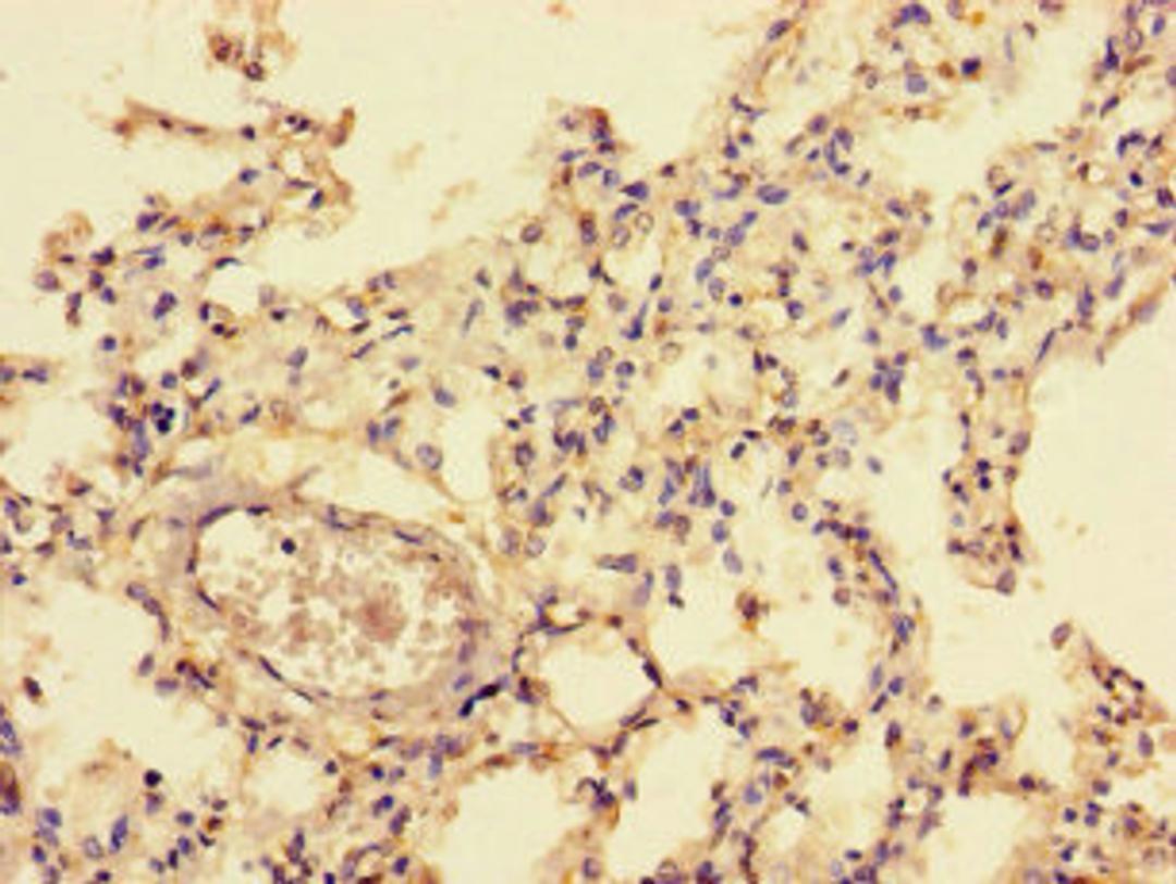 Immunohistochemistry of paraffin-embedded human lung tissue using CSB-PA015756LA01HU at dilution of 1:100