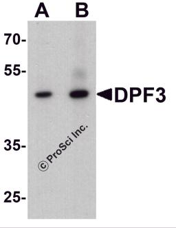 Western blot analysis of DPF3 in mouse brain tissue lysate with DPF3 antibody at (A) 1 and (B) 2 &#956;g/ml.