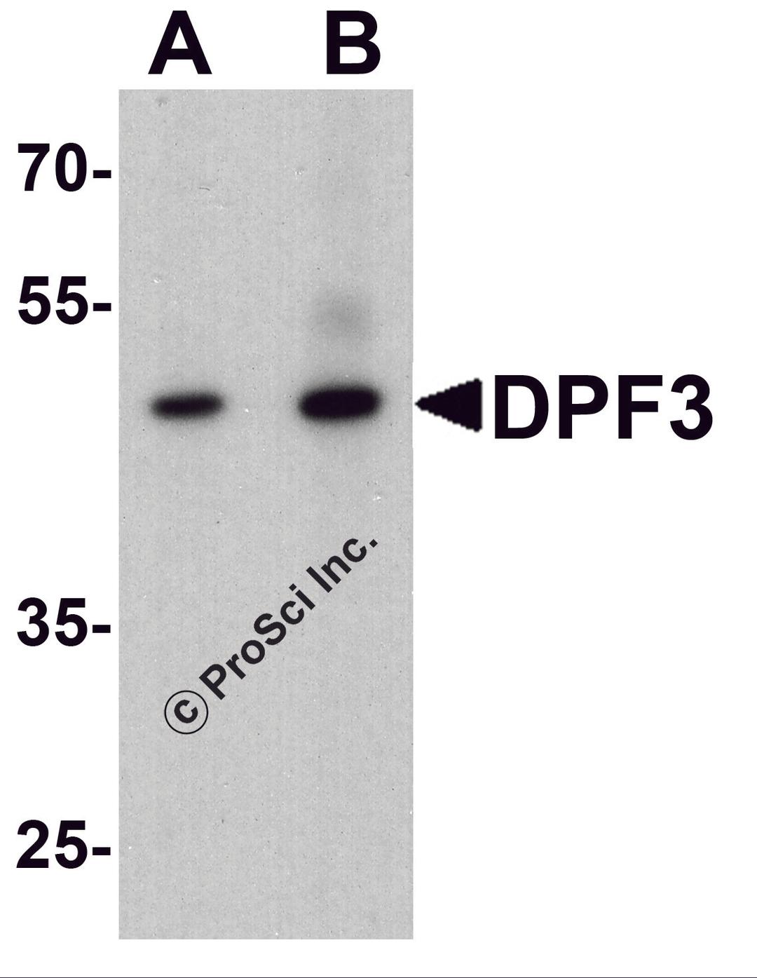 Western blot analysis of DPF3 in mouse brain tissue lysate with DPF3 antibody at (A) 1 and (B) 2 μg/ml.