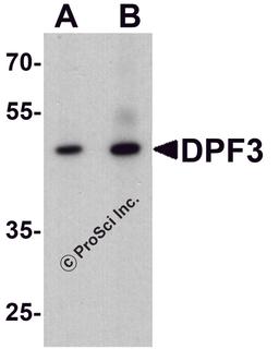 Western blot analysis of DPF3 in mouse brain tissue lysate with DPF3 antibody at (A) 1 and (B) 2 μg/ml.