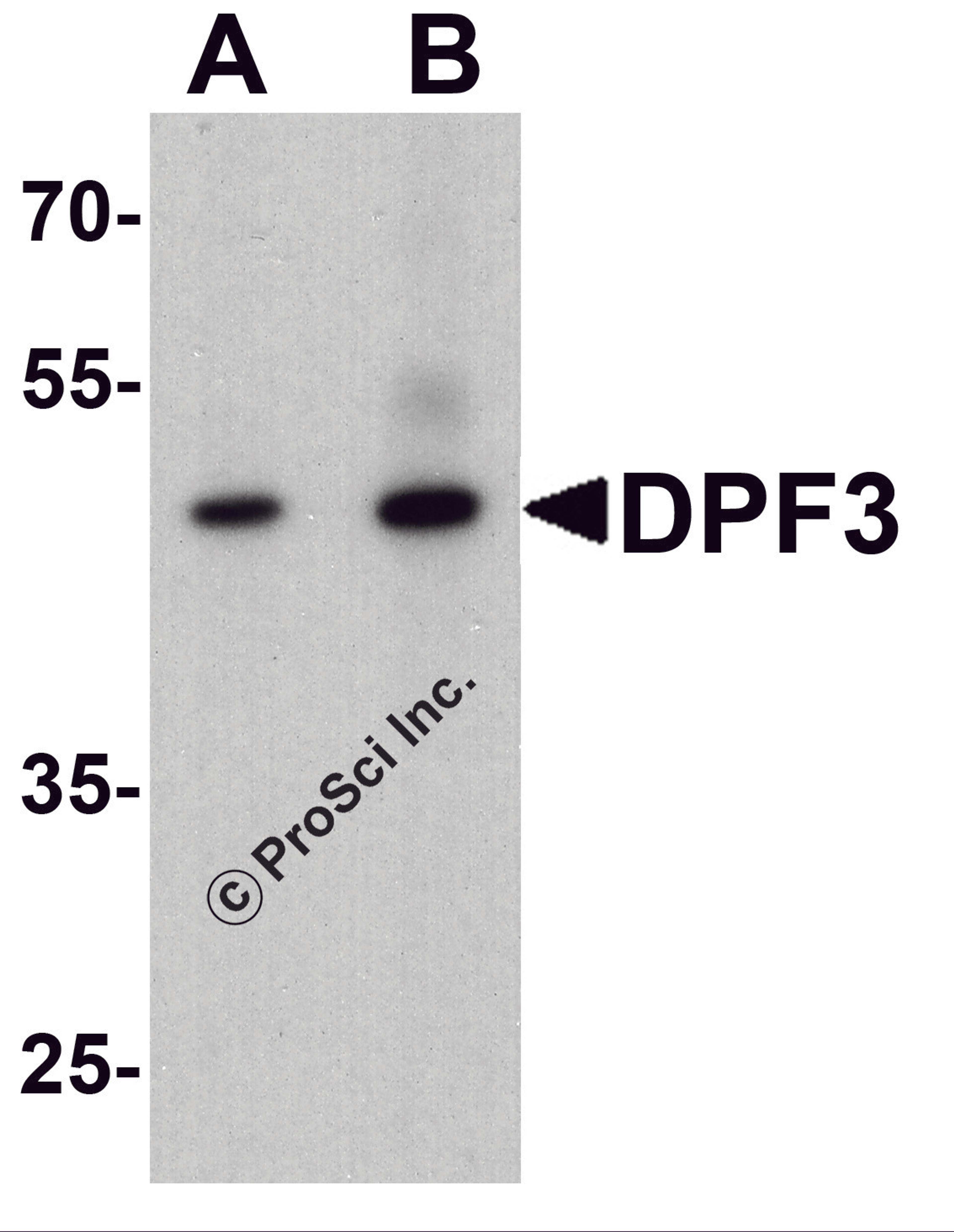 Western blot analysis of DPF3 in mouse brain tissue lysate with DPF3 antibody at (A) 1 and (B) 2 μg/ml.