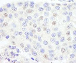 Detection of human GTF3C1/TFIIIC220 by immunohistochemistry.