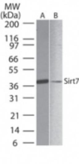 Western Blot: SIRT7 Antibody [NB100-56364] - Analysis of SIRT7 in A) human liver and B) PBMC lysate using this antibody at 1 ug/ml.