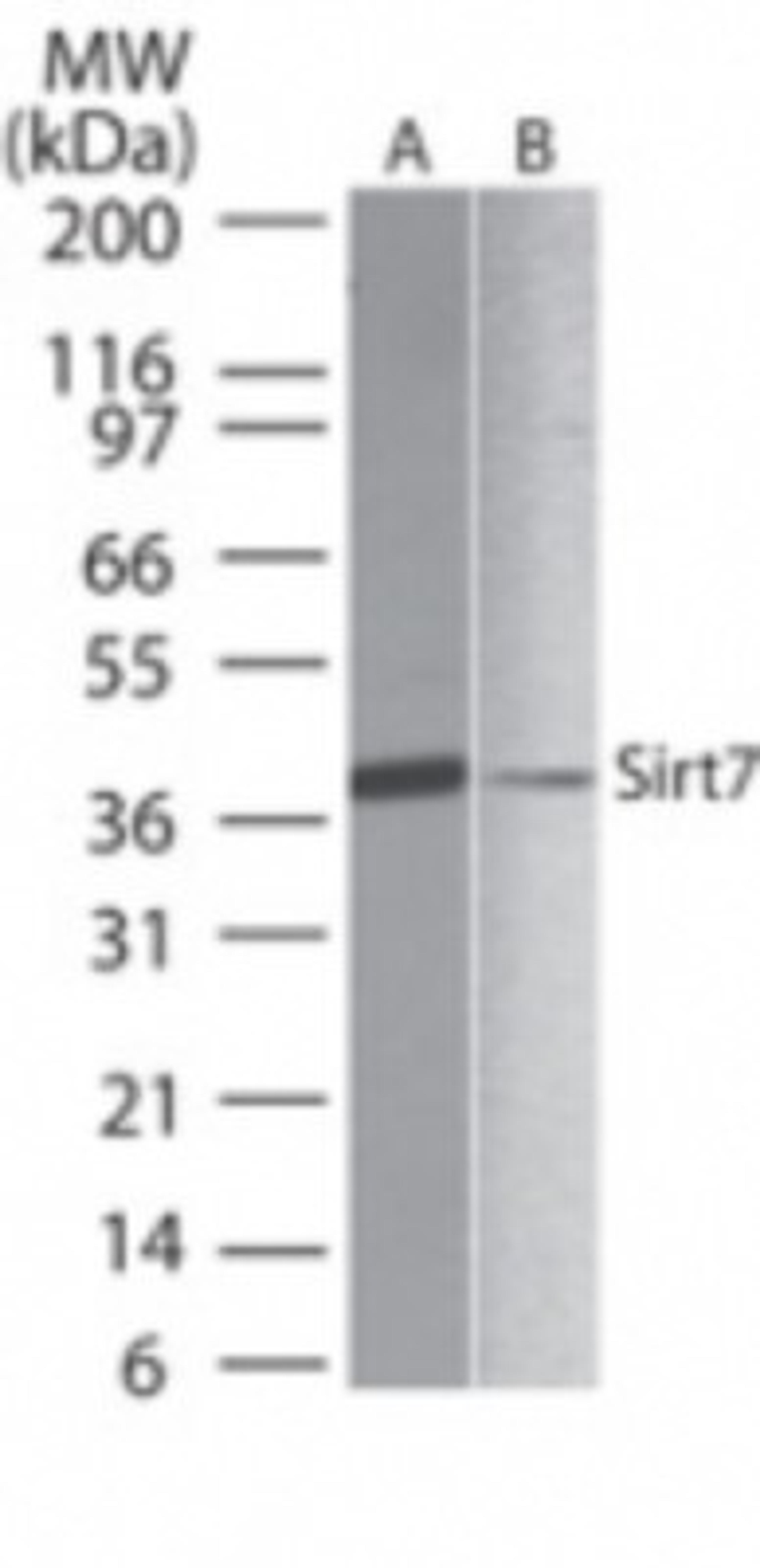 Western Blot: SIRT7 Antibody [NB100-56364] - Analysis of SIRT7 in A) human liver and B) PBMC lysate using this antibody at 1 ug/ml.